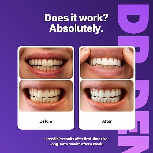 DRDENT Purple Teeth Whitening Strips 21 Treatments - Safe for Enamel - Non Sensitive Teeth Whitening - Whitening Without Any Harm - Pack of 42 thumbnail 7