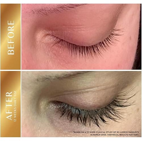 LUXROS Eyelash Serum 5 mL, Eyelash Enhancer Serum for Longer, Thicker Healthier Lashes, Made in USA, 5mL 6 Month Supply thumbnail 2