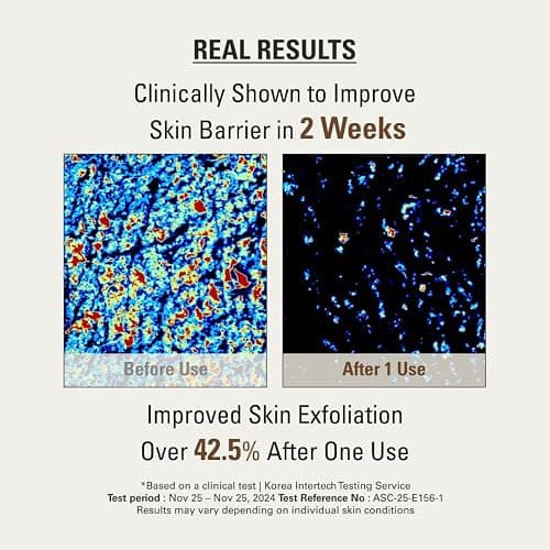 SIOT Rice Jam Mask 8.45 Ounce – Korean Icheon Rice Face & Body Mask for Deep Cleansing, Hydrating, & Radiant Skin – Natural Moisturizing & Purifying Skincare, Smooth & Soft Skin Treatment thumbnail 5