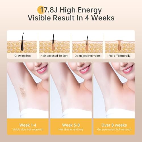 IPL Laser Hair Removal Device for Women and Men | At-Home Use, For Arms Legs Armpits Bikini Line thumbnail 4