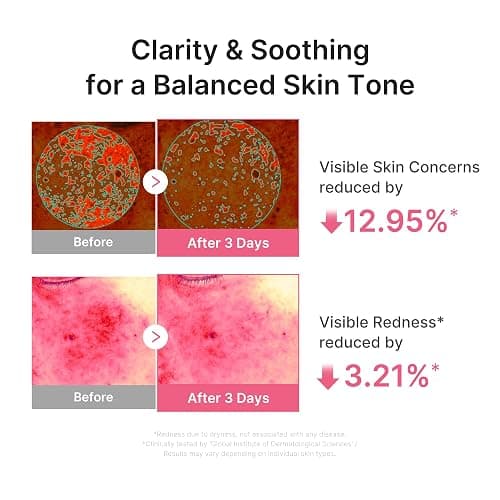 medicube PDRN Pink Peptide Serum with Salmon DNA, 3.71 fl. Oz | Ultra Light Hydrating Serum with Hyaluronic Acid - Fast-Absorbing Glow Care for Skin Clarity, Korean Skincare, 3.71 fl. Oz thumbnail 4