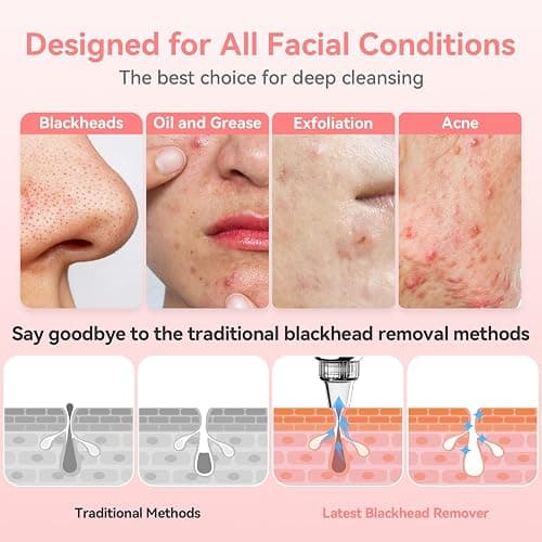 Blackhead Remover Pore Vacuum Upgraded Facial Pore Cleaner Electric Comedone Whitehead Extractor Tool-5 Suction Power,5 Probes,USB Rechargeable Blackhead Vacuum Kit for Women & Men thumbnail 5