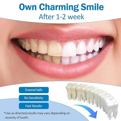 KTSAY Teeth Whitening Pen - Professionally Stain Removal Teeth Whitening Gel Formula, No Sensitivity Effective Teeth Whitener, Mint (0.11 Fl Oz (Pack of 4)) thumbnail 2