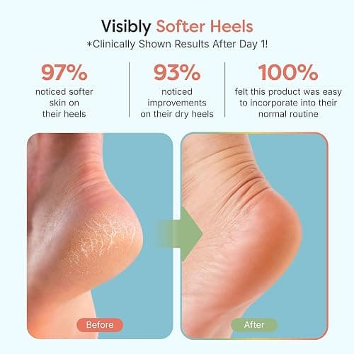 ZenToes Moisturizing Socks for Cracked Heel Treatment, Vitamin E, Olive Oil and Jojoba Oil Heel Socks, Stocking Stuffers for Women, Spa Self Care Gifts for Women (Fuzzy Blue, Regular) thumbnail 3