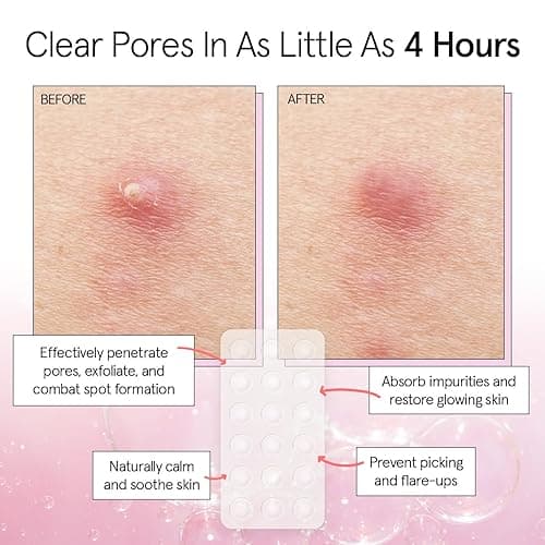 grace & stella Award Winning Pore Strip Pimple Patches for Face - Hydrocolloid Acne Patches for Shrinking Zits, Whiteheads - Spot Stickers - Dermatologist-Tested, Vegan (Invisible, 72 Count) thumbnail 4