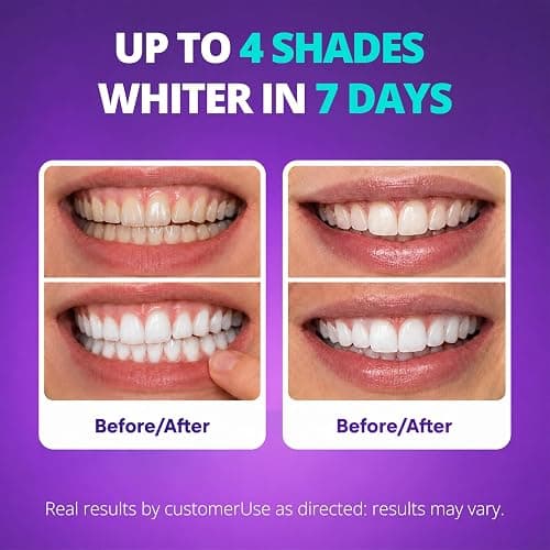 SAKYPRORAL Purple Whitening Strips, 90-Day Long-Lasting Results, Enamel Safe & Low-Sensitivity, Professional Teeth Whitening Strips with Non-Slip Dry Strip Technology (28 Count (Pack of 1)) thumbnail 2