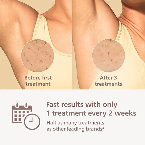 Philips Lumea 8000 Series IPL Hair Removal Device, Permanent Laser Hair Reduction for Women & Men, Easy and Comfortable Use at Home, SenseIQ, 3 Attachments for Body, Face, Intimate, BRI937/03 thumbnail 4