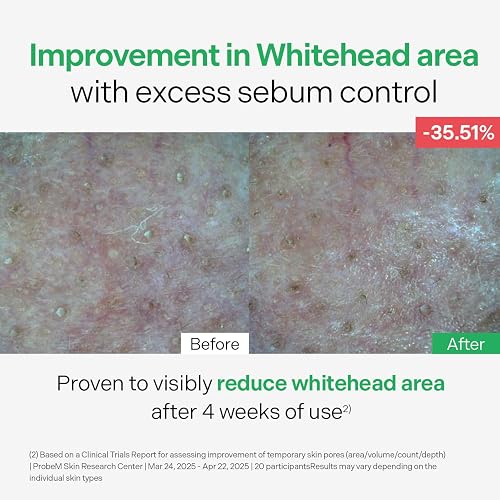 torriden control serum thumbnail 7