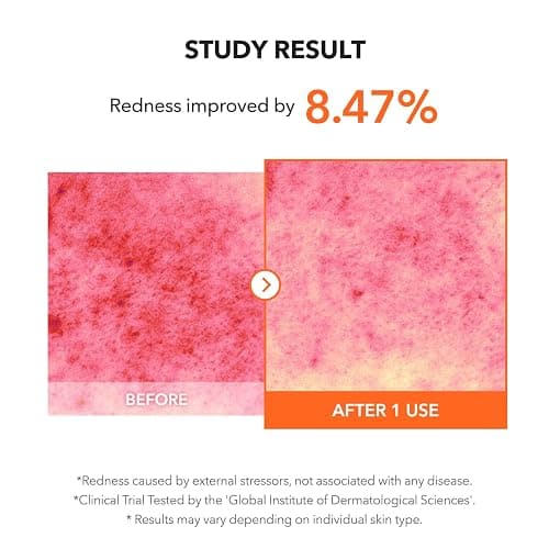 APRILSKIN Carrotene IPMP™ Clearing Solution || Quickly soothes troubled areas and helps clear blemishes | Formulated with BHA, AHA, Niacinamide & Zinc Oxide | Vegan, Cruelty-Free (0.67fl.oz.) thumbnail 7