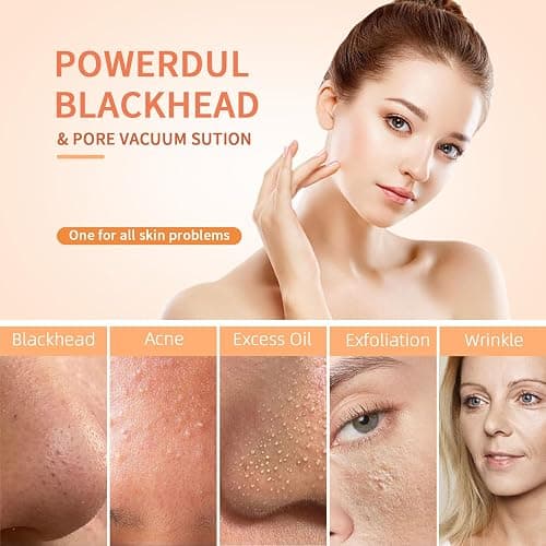 2025 Pore Vacuum, USB Rechargeable Blackhead Remover Vacuum,3 Levels Adjustable Pore Vacuum Blackhead Remover, with 5 Suction Power,6 Probes,Face Vacuum Pore Cleanser for Women & Men-White thumbnail 5