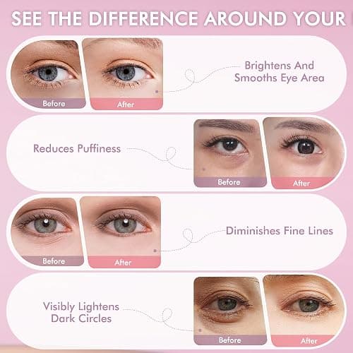 AzLucaky Under Eyes Patches, 40 Pairs Rose Hydrogel Eye Mask for Puffy Eyes and Dark Circles with Rose Essence, Hyaluronic Acid & Niacinamide, Deep Hydrating Eye Treatment for Men & Women thumbnail 6