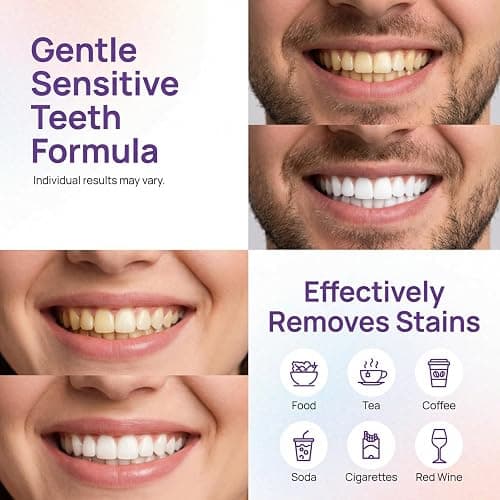Purple Whitening Strips, 28 Strips Color Correcting Purple Teeth Whitening Strips for Sensitive Teeth, Removes Yellow Stains, Enamel Safe | 30 Min Instant | 90-Day Long-Lasting Results thumbnail 3