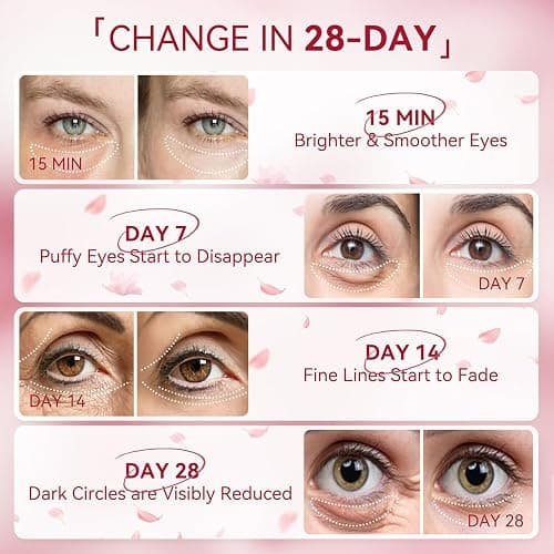 BREYLEE Rose Eye Mask– 60 Pcs, Under Eye Patches, Patches For Puffy Eyes,Hydrates, Improves And Firms The Eye Area, Suitable For Both Women And Men. thumbnail 6