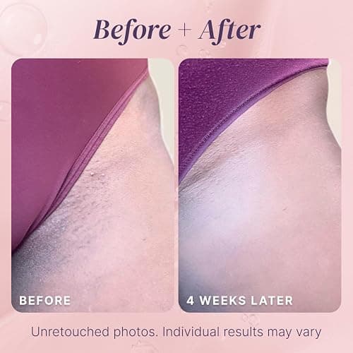Razor Bump Stopper with Dark Spot Remover, Ingrown Hair Treatment for Bikini Area and Razor Bumps Treatment - Salicylic Acid After Shave Solution for Ingrown Hairs & Razor Burns thumbnail 8