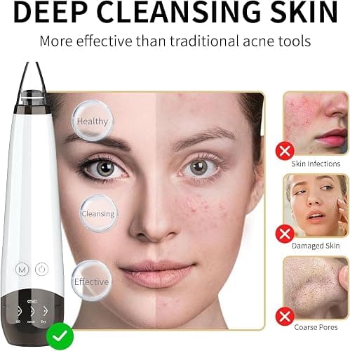 Blackhead Remover Pore Vacuum, Visual Rechargeable Blackhead Vacuum Facial Pore Cleaner-3 Suction Soft Silicone,3 Probes,USB Kit Electric Acne Extractor Tool for Adult thumbnail 2