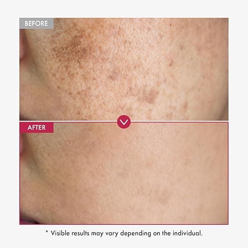 TOSOWOONG Niacinamide 10% + Tranexamic Acid 4% Serum, Arbutin 2%, Hyaluronic Acid, TXA Facial Serum, Glass Skin, Clarifying, Radiant Complexion with Natural Color, Korean Skin care, 33ml, 1.11 fl.oz. thumbnail 3