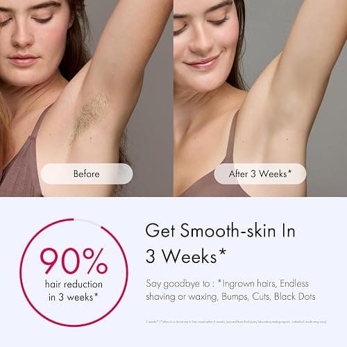Ulike Laser Hair Removal for Women and Men, Air 3 Ice-Cooling IPL Hair Removal Device for Nearly Painless & Long-Lasting Results, 3 Modes & Auto Flashing for Fast Full Body Hair Removal from Home thumbnail 3