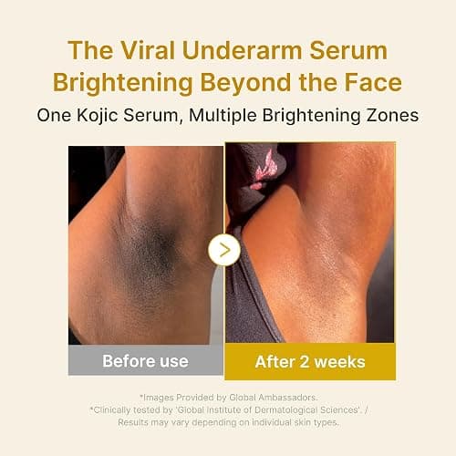 medicube Kojic Acid Turmeric Clarifying & Balancing Capsule Serum for Troubled Skin | Soothing & Brightening Facial Serum | Niacinamide & Glow Capsules for Hydration and Barrier Support | 1.01 fl.oz thumbnail 4