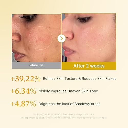 medicube Kojic Acid Turmeric Smoothing Toner for Face & Body | Lightweight Toner for Balancing Uneven Skin Tone & Texture | Niacinamide, Glycolic Acid for Clear Glass Skin | 8.45 fl.oz thumbnail 4