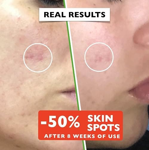 Big 2.11oz. Organic Vitamin C Serum for Face. Anti-Dark Spots, Wrinkles Skin Repair Serum with Hyaluronic Acid, Vitamin C & Niacinamide. All-in-One Brightening, Anti Aging Facial & Eye Area Skincare thumbnail 4