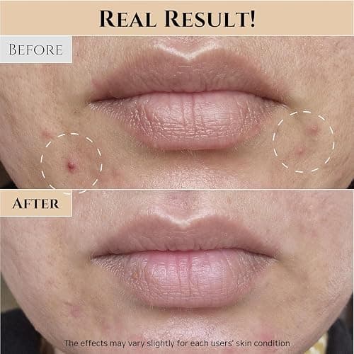 Beauty of Joseon Lotion tonique visage au riz régénérante pour peaux mixtes grasses Soin hydratant et équilibrant coréen 150 ml thumbnail 5