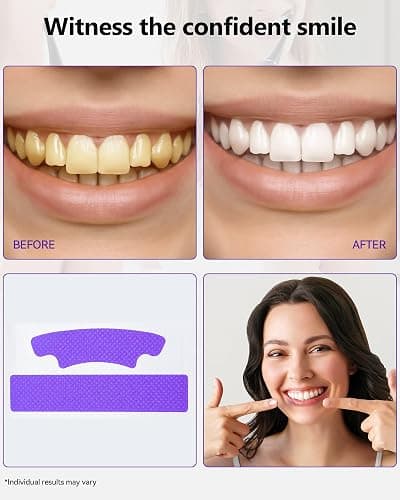 Teeth Whitening Strips 14 Treatments, Enamel Safe for Sensitive Tooth, Whitens Teeth, Purple Whitening Strips, Removes Yellow Stains & Bad Breath - Effective Color Correction for a Brighter Smile thumbnail 3