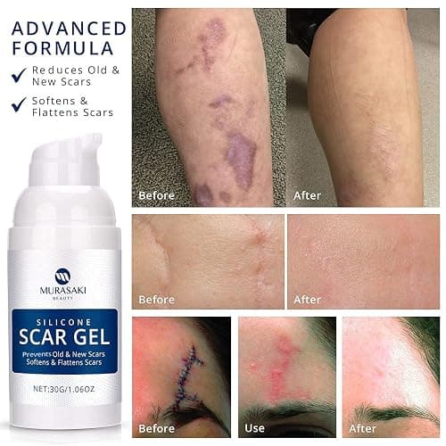 100% Silicone Scar Gel Scar Cream - Advanced Scar Gel for Surgical Scars, C-Section, Stretch Marks, Acne, Injury, Burns, Keloids, Old and New Scars 1.06oz(30g) (Maximum Strength 100% Silicone) thumbnail 3