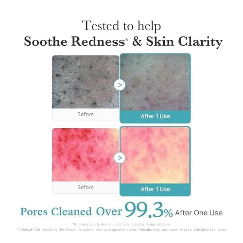 medicube Azelaic Acid Gummy Whip Cleanser | Cleansing Foam For Troubled Skin | Use After Spot Care & Excess Sebum Control | Niacinamide, Glycerin | Soothing, Pore Cleansing Face Wash | Korean Skincare thumbnail 4