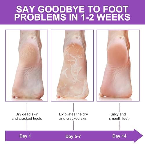 ALIVER Foot Peel Mask 3 Pack, Exfoliator Peel Off Calluses Dead Skin Callus Remover, Baby Soft Smooth Touch Feet-Men Women (Lavender) thumbnail 7
