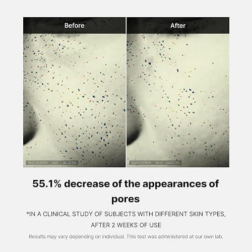 Medicube Zero Pore One-Day Cream 1.69 fl.oz - Visibly Smaller Pores, Controls Excess Oil - Pore Refining Cream with Panthenol, Salicylic Acid, and Niacinamide - Korean Skincare thumbnail 5