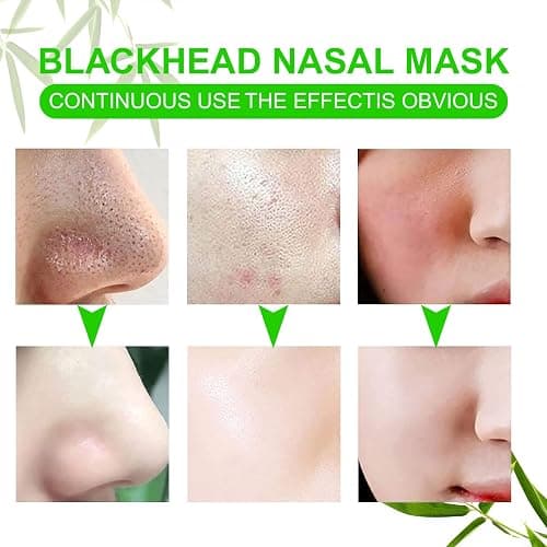 JWBVCTCR Pore Strips,Natural Charcoal Deep Cleansing Pore Strips ，Nose Strips for Blackheads，Black Heads Removal for Nose Face，Deep Cleansing for All Skin Types(80pcs) thumbnail 7