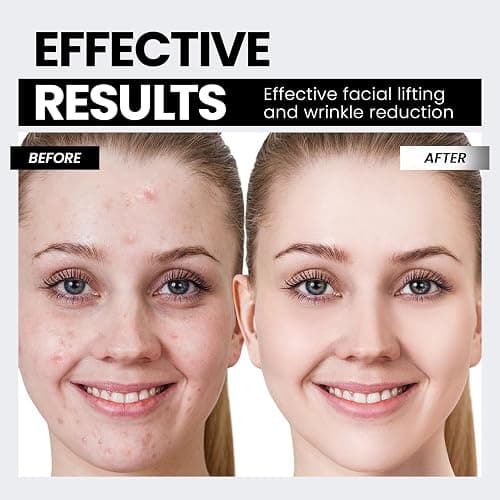 Microcurrent Facial Device,Latest Red Light Technology，Enhances The Ability to Lift The Face and Tighten The Skin，Facial Wrinkle Equipment，Smart Photon Micro-Current Device, Model:EP-300. thumbnail 4
