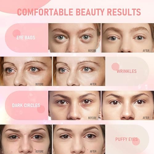Eye Mask - 30 Pairs Rose Under Eye Patches Skin Care Products,Eye Masks Skincare for Dark Circles and Puffiness, Reduce Wrinkles, Eye Bags and Fine Lines, for Women and Man - Rose thumbnail 6