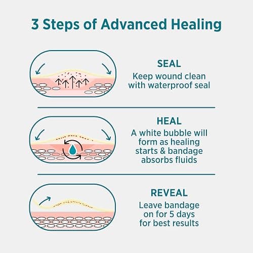 BAND-AID Brand Pro Heal Hydrocolloid Blister Bandages for Advanced Healing, 100% Waterproof, Extra Cushion for Blister Protection and Less Scarring Versus Uncovered Wound, 6 ct thumbnail 7