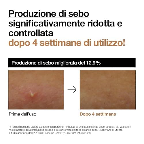 ANUA Rice 70% Glow Milky Toner thumbnail 6