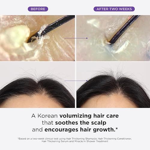 Dr. Groot Thickening Serum, Shampoo, Conditioner, and Scalp Treatment Set for Hair Loss – Clinical Results with Biotin and Rosemary for Hair Thinning, Shedding, Scalp Repair and Treatment thumbnail 3