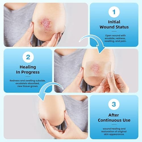 Hydrocolloid Roll Bandages, 2IN x 12FT Extra Large Hydrocolloid Patch with Self-Adhesive, Ultra Absorbent, Cut-to-Size, Flexible & Waterproof for Burn, Blister, Acne Care, First Aid Kit Essential thumbnail 7