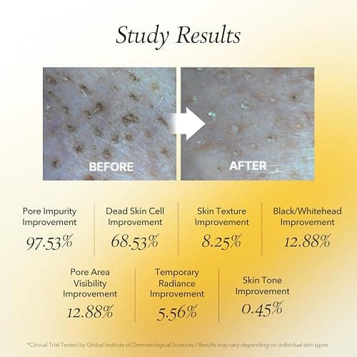 APRILSKIN Calendula Flower-Infused Facial Peel Off Mask, 3.52 fl. oz, PHA, BHA & Niacinamide gently exfoliates, removes impurities, improves uneven skin tone, and minimizes pores, Korean Skincare thumbnail 7