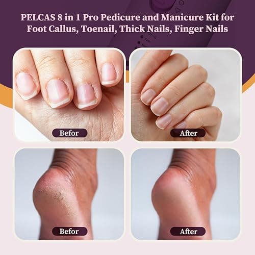 PELCAS Toenail Grinder for Thick Toenails 8 in 1 Manicure & Pedicure Kit, 5 Speeds Cordless Nail Drill with LED Light Electric Foot Callus Remover for Foot Callus, Thick Nails, Finger Nails Pink thumbnail 2