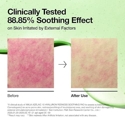 Anua Azelaic Acid 10 Hyaluronic Acid Soothing Toner Pads, 90 Pads | Hydrating Facial Toner Pads for Redness, Pore & Blemish Care, Quick & Easy Stretchable Formula, Korean Skincare thumbnail 6