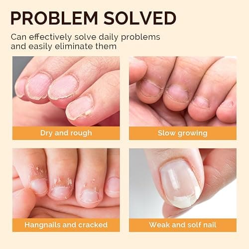 MelodySusie 6Pcs Cuticle Oil Pen Set,Nail Moisturizing Cuticle Oil Enriched with Vitamin E,Softens and Repairs Cuticles,Nail Strengthener,Protects Damaged Skin,Thin Nails,for Home and Salon Use thumbnail 2