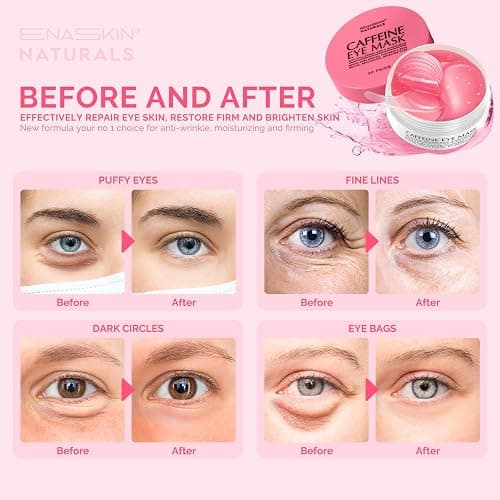 Under Eye Patches for Dark Circles: Caffeine Gel Masks for Puffiness Undereye Bags Wrinkles - Instant Brightening Moisturizing Skin Treatment Pads - Gift for Mom Traveler Night Worker, 30 Pairs (Pink) thumbnail 2
