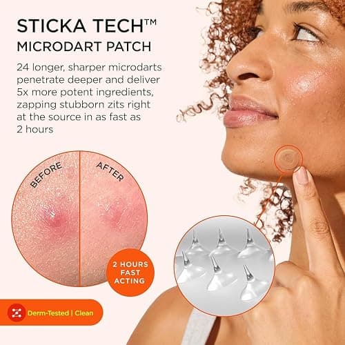 ZitSticka KILLA Extra Strength Patches for Face - Medical Grade Acne Patch - Fast Acting Advanced Microdart Patch for Early-Stage Zits - Starts Working Within 2 Hours - 4 Count thumbnail 2