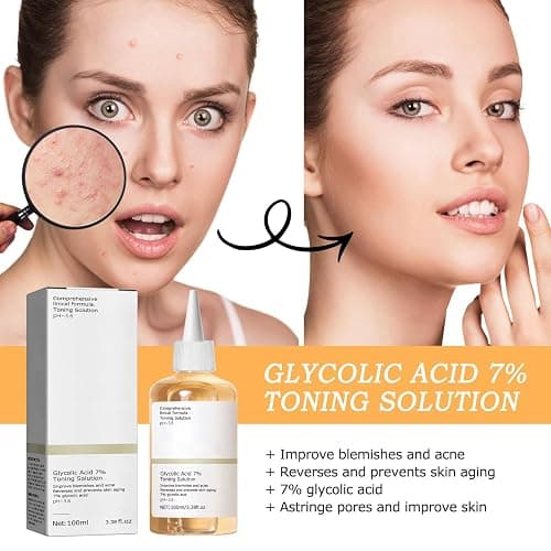 Angozo Glycolic Acid Toner,GlykolsäUre Peeling 7%-Ige -LöSung FüR Hautunreinheiten Und Akne, Toner Suitable for Combination and Oily Skin, Porenbehandlung(100ml) thumbnail 2