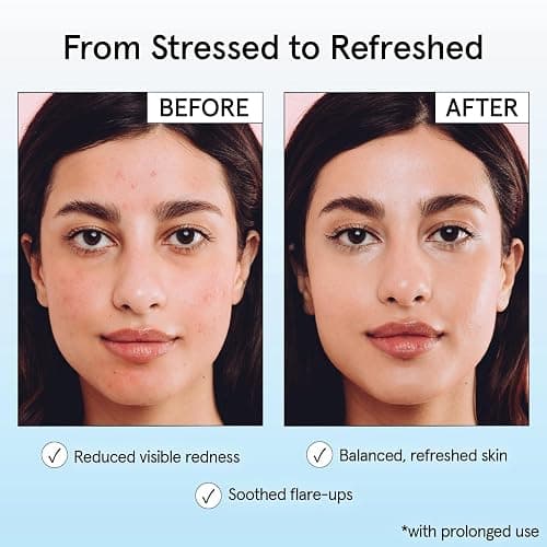 grace & stella Hypochlorous Acid Spray - Gentle Face Spray to Calm Redness & Flare-Ups - Soothing Facial Mist for Sensitive Skin (120 ml/4.22 fl oz) thumbnail 4