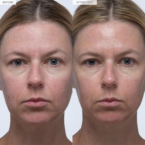 Glow Recipe Brighten + Hydrate Treatment Duo - Guava Vitamin Dark Spot C Serum (30ml) & Plum Plump Hyaluronic Serum (30ml) - Hydrate, Help Diminish the Look of Dark Spots & Even Tone thumbnail 4