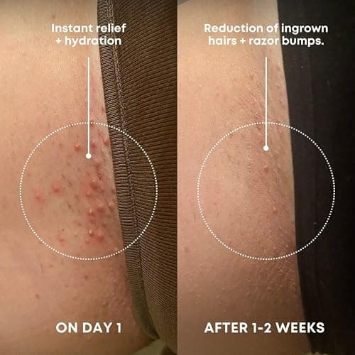 Bushbalm Ingrown Hair Exfoliating Scrub - Reduces Appearance of Ingrown Hairs and Razor Bumps, Soothes Skin and Post-Shave Redness - Nude, 236 ml thumbnail 2