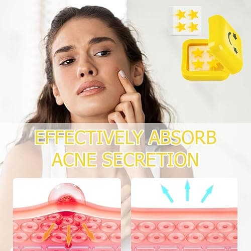 AWAVM 40 Parches de Acné Hidrocoloide, Parches de Acné en Forma de Estrella, Parches Acne, Pimple Patches Facial, con Caja de Espejo Portátil thumbnail 4
