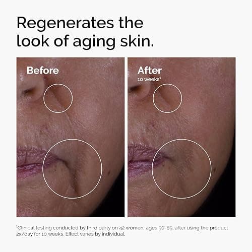 The Ordinary GF 15% Solution, Anti-Aging Formula for Visible Skin & Wrinkle Repair, 1 Fl Oz thumbnail 4