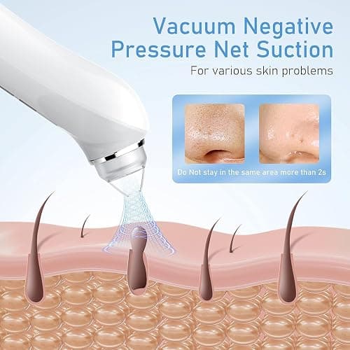 Blackhead Remover Vacuum, USB Interface Type Pore Vacuum, Black Head Extractions Tool with Camerafor, Men and Women Pore Cleaner, 3 Adjustment Modes & 6 Suction Heads(Light Pink) thumbnail 3